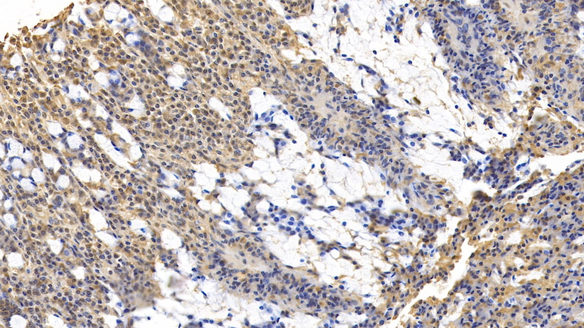 DAB staining on IHC-P; Samples: Human Placenta Tissue; Primary Ab: 10ug/ml Mouse Anti-Human GPC3 Antibody; Second Ab: 2ug/mL HRP-Linked Caprine Anti-Mouse IgG Polyclonal Antibody
