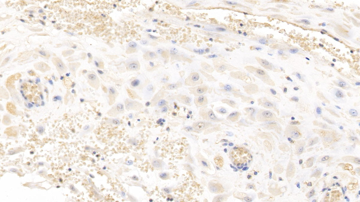 Glypican 3 (GPC3) Monoclonal Antibody - image 3