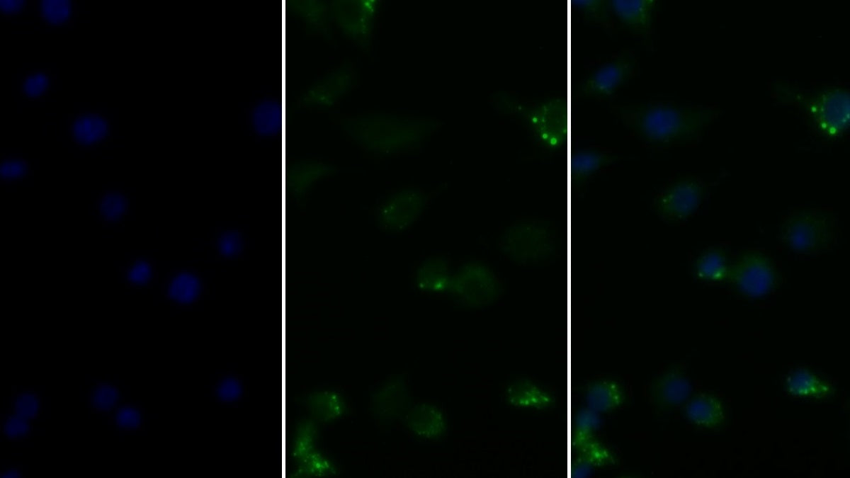 Tumor Necrosis Factor Alpha (TNFa) Monoclonal Antibody - image 2
