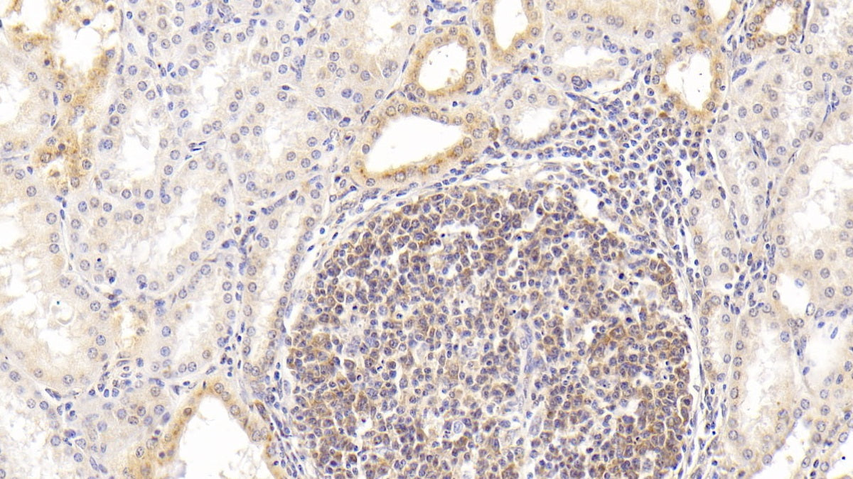 Procalcitonin (PCT) Monoclonal Antibody - image 2