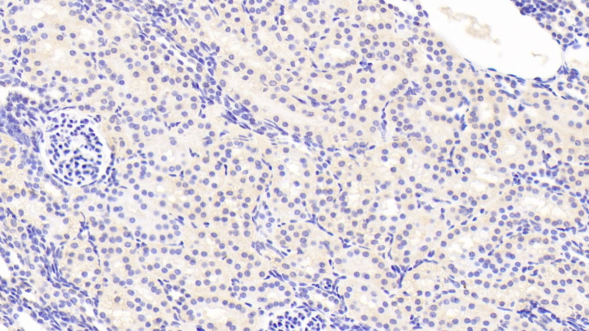 DAB staining on IHC-P; Sample: Human Colon Tissue; Primary Ab: 20ug/ml Mouse Anti-Human PCT Antibody; Second Ab: 2ug/mL HRP-Linked Caprine Anti-Mouse IgG Polyclonal Antibody