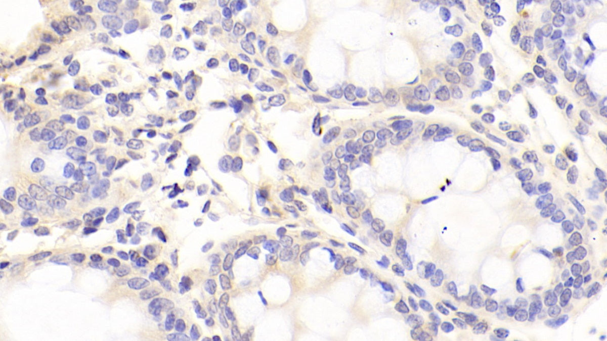 Procalcitonin (PCT) Monoclonal Antibody - image 3