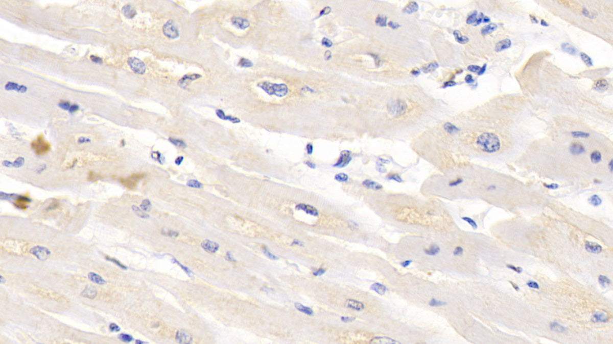 DAB staining on IHC-P; Sample: Human Cerebellum Tissue; Primary Ab: 30ug/ml Mouse Anti-Human TUBb Antibody; Second Ab: 2ug/mL HRP-Linked Caprine Anti-Mouse IgG Polyclonal Antibody