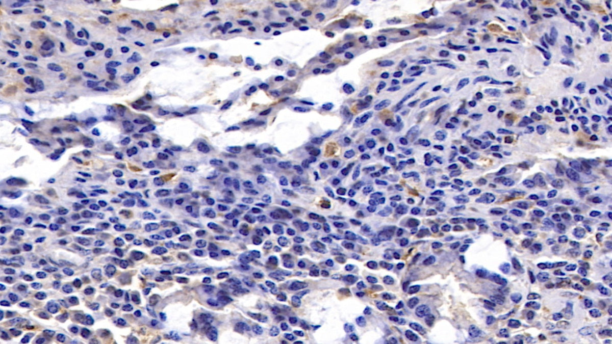 Interleukin 17 (IL17) Monoclonal Antibody - image 2