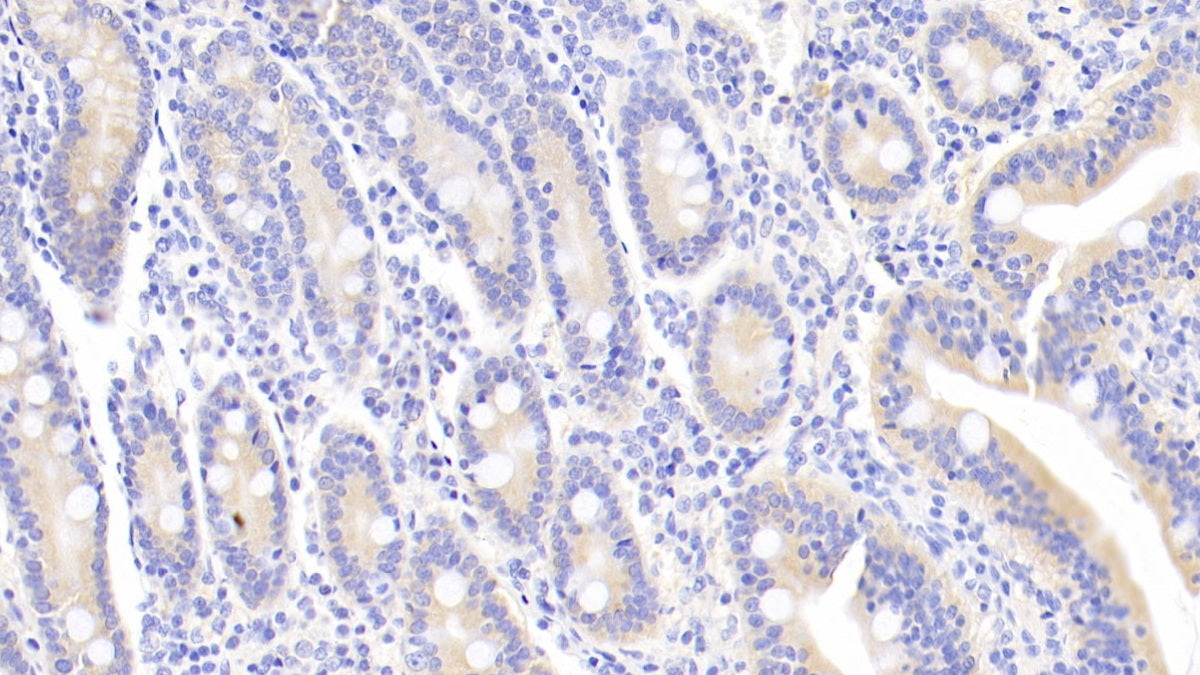 Leukemia Inhibitory Factor (LIF) Monoclonal Antibody - image 2