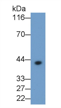 Western Blot; Sample: Porcine Pancreas lysate; Primary Ab: 0.4ug/ml Mouse Anti-Human IL1b Antibody; Second Ab: 0.2ug/mL HRP-Linked Caprine Anti-Mouse IgG Polyclonal Antibody