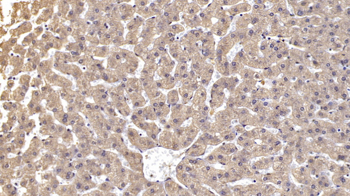 DAB staining on IHC-P; Sample: Human Cerebrum Tissue; Primary Ab: 10ug/ml Mouse Anti-Human Reelin Antibody; Second Ab: 2ug/mL HRP-Linked Caprine Anti-Mouse IgG Polyclonal Antibody