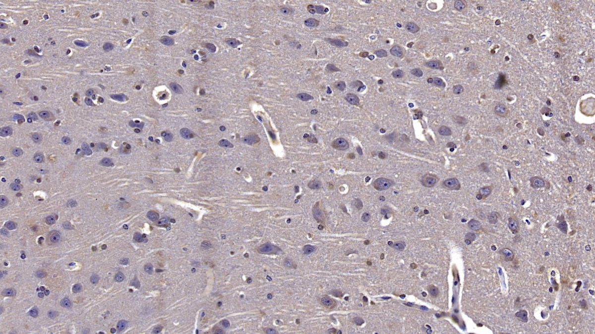 Western Blot; Sample: U87MG cell lysate Primary Ab: 3ug/ml Mouse Anti-Human Reelin Antibody Second Ab: 0.2ug/mL HRP-Linked Caprine Anti-Mouse IgG Polyclonal Antibody