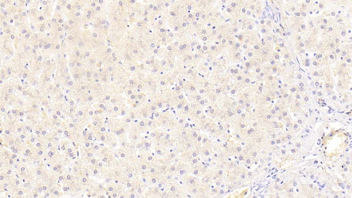 DAB staining on IHC-P; Sample: Human Cardiac Muscle Tissue; Primary Ab: 10ug/ml Mouse Anti-Human BECN1 Antibody; Second Ab: 2ug/mL HRP-Linked Caprine Anti-Mouse IgG Polyclonal Antibody