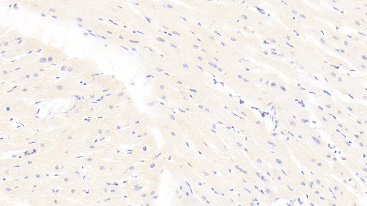 DAB staining on IHC-P; Sample: Human Kidney Tissue; Primary Ab: 10ug/ml Mouse Anti-Human BECN1 Antibody; Second Ab: 2ug/mL HRP-Linked Caprine Anti-Mouse IgG Polyclonal Antibody