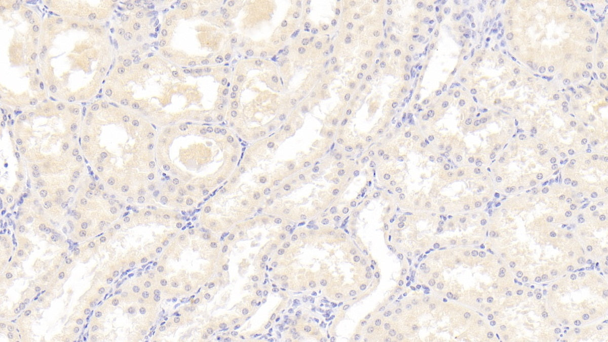 Western Blot; Sample: Mouse Cerebrum lysate Primary Ab: 5ug/ml Mouse Anti-Human BECN1 Antibody Second Ab: 0.2ug/mL HRP-Linked Caprine Anti-Mouse IgG Polyclonal Antibody