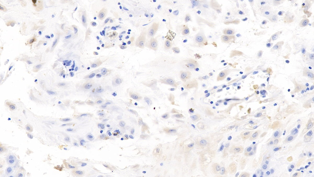 Western Blot; Sample: Human Leukocyte lysate Primary Ab: 2ug/ml Mouse Anti-Human IL7 Antibody Second Ab: 0.2ug/mL HRP-Linked Caprine Anti-Mouse IgG Polyclonal Antibody