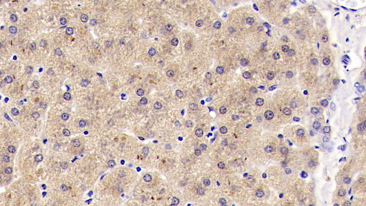 DAB staining on IHC-P; Samples: Human Cerebrum Tissue; Primary Ab: 20ug/ml Mouse Anti-Human Reelin Antibody; Second Ab: 2ug/mL HRP-Linked Caprine Anti-Mouse IgG Polyclonal Antibody