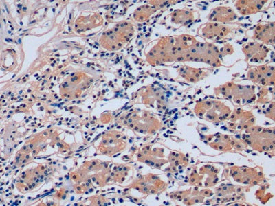 DAB staining on IHC-P; Sample: Human Liver Tissue; Primary Ab: 20ug/ml Mouse Anti-Human FGF21 Antibody; Second Ab: 2ug/mL HRP-Linked Caprine Anti-Mouse IgG Polyclonal Antibody