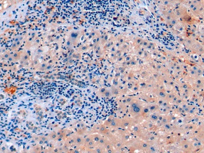 Fibroblast Growth Factor 21 (FGF21) Monoclonal Antibody - image 3