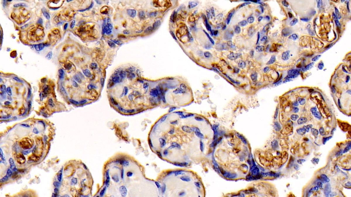 Insulin Like Growth Factor 1 (IGF1) Monoclonal Antibody - image 2