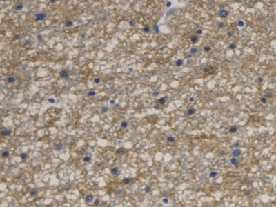 DAB staining on IHC-P; Sample: Human Cerebrum Tissue; Primary Ab: 20ug/ml Mouse Anti-Human AQP4 Antibody; Second Ab: 2ug/mL HRP-Linked Caprine Anti-Mouse IgG Polyclonal Antibody