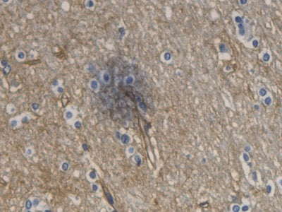 DAB staining on IHC-P; Sample: Human Cerebrum Tissue; Primary Ab: 20ug/ml Mouse Anti-Human AQP4 Antibody; Control: Used PBS instead of primary antibody; Second Ab: 2ug/ml HRP-Linked Caprine Anti-Mouse IgG Polyclonal Antibody