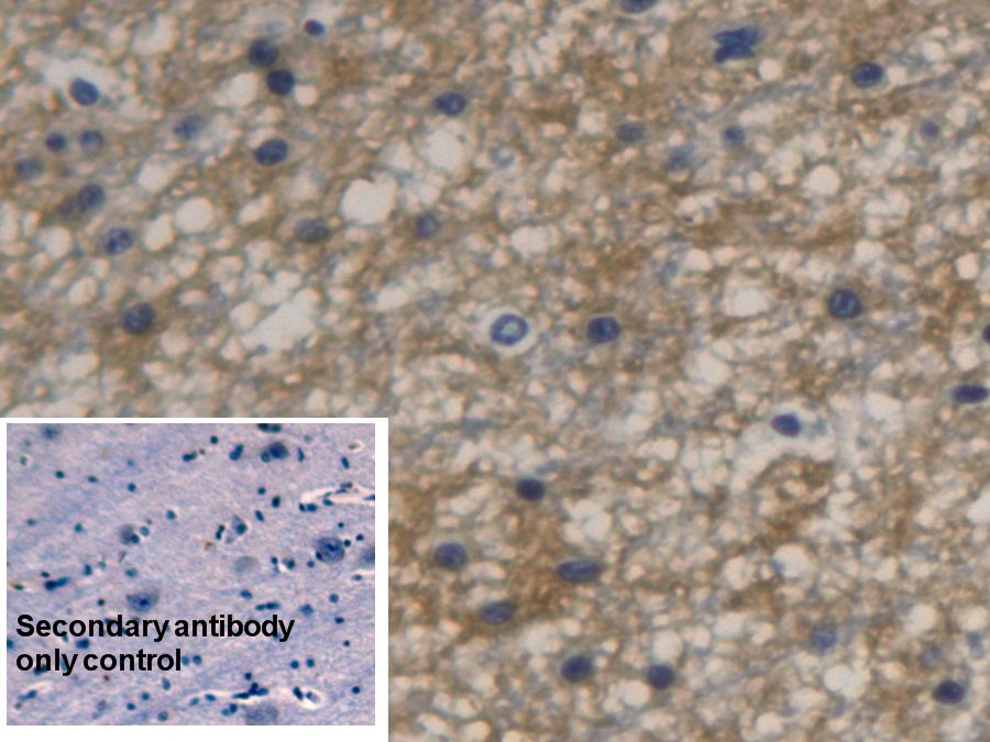 DAB staining on IHC-P; Sample: Human Glioma Tissue; Primary Ab: 20ug/ml Mouse Anti-Human AQP4 Antibody; Control: Used PBS instead of primary antibody; Second Ab: 2ug/ml HRP-Linked Caprine Anti-Mouse IgG Polyclonal Antibody