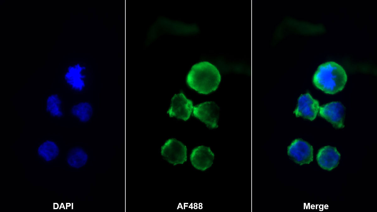 Stromal Cell Derived Factor 1 (SDF1) Monoclonal Antibody - image 2