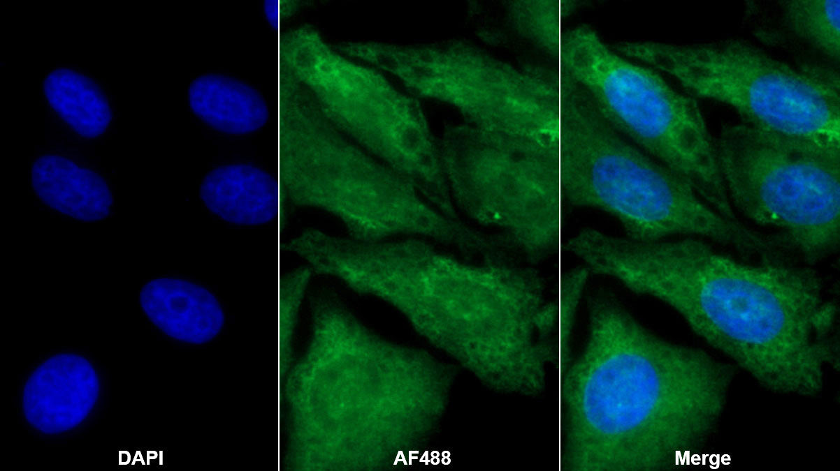 Transforming Growth Factor Beta 3 (TGFb3) Monoclonal Antibody - image 3