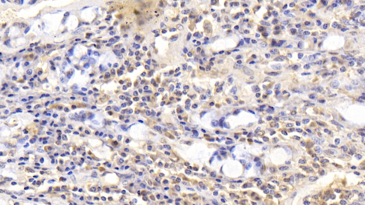 DAB staining on IHC-P; Sample: Human Kidney Tissue; Primary Ab: 20ug/ml Mouse Anti-Human CNX Antibody; Second Ab: 2ug/mL HRP-Linked Caprine Anti-Mouse IgG Polyclonal Antibody
