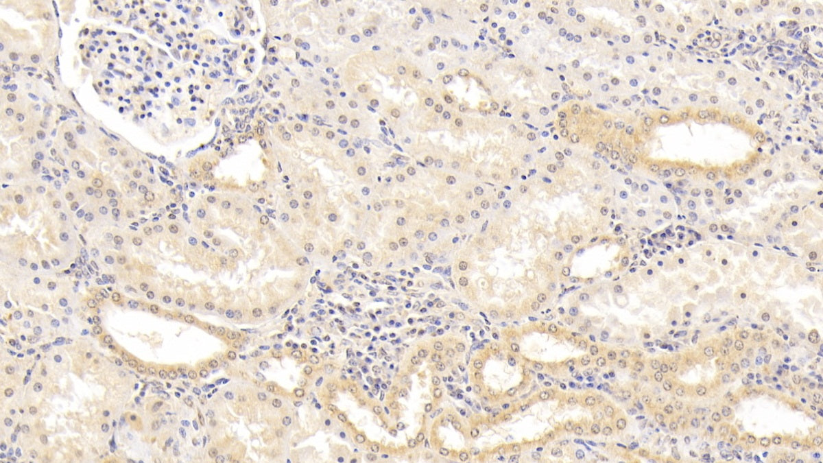 DAB staining on IHC-P; Sample: Human Cardiac Muscle Tissue; Primary Ab: 20ug/ml Mouse Anti-Human CNX Antibody; Second Ab: 2ug/mL HRP-Linked Caprine Anti-Mouse IgG Polyclonal Antibody