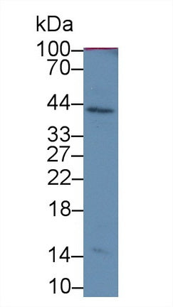 Serpin B3 (SERPINB3) Monoclonal Antibody - image 4