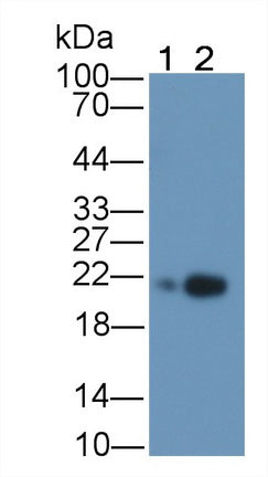 Ferritin, Light Polypeptide (FTL) Monoclonal Antibody - image 4