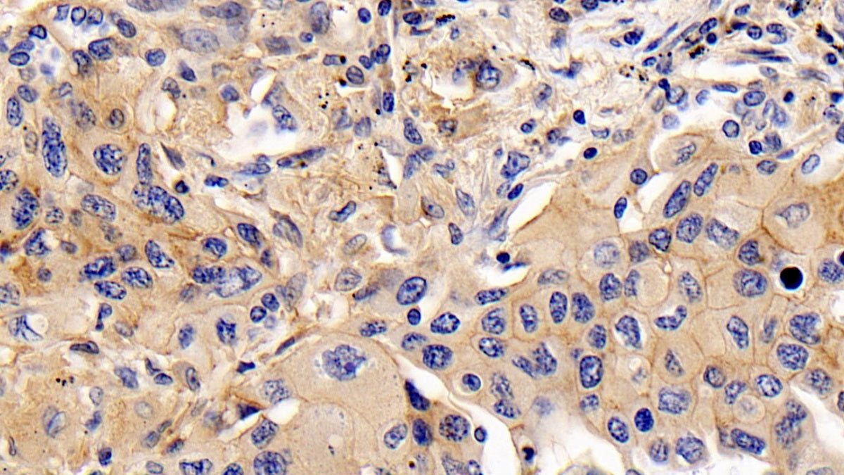 DAB staining on IHC-P; Sample: Human Adrenal gland Tissue; Primary Ab: 30ug/ml Mouse Anti-Human CD147 Antibody; Second Ab: 2ug/mL HRP-Linked Caprine Anti-Mouse IgG Polyclonal Antibody