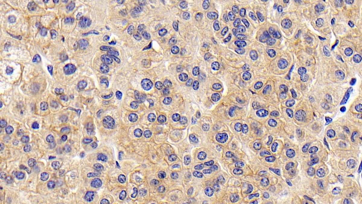 DAB staining on IHC-P; Sample: Human Stomach Tissue; Primary Ab: 30ug/ml Mouse Anti-Human CD147 Antibody; Second Ab: 2ug/mL HRP-Linked Caprine Anti-Mouse IgG Polyclonal Antibody