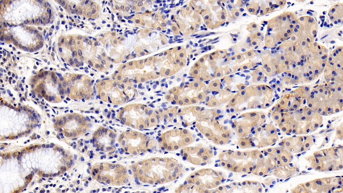 Cluster Of Differentiation 147 (CD147) Monoclonal Antibody - image 5