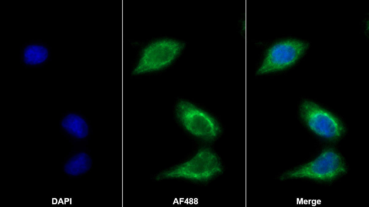Bone Morphogenetic Protein 7 (BMP7) Monoclonal Antibody - image 3