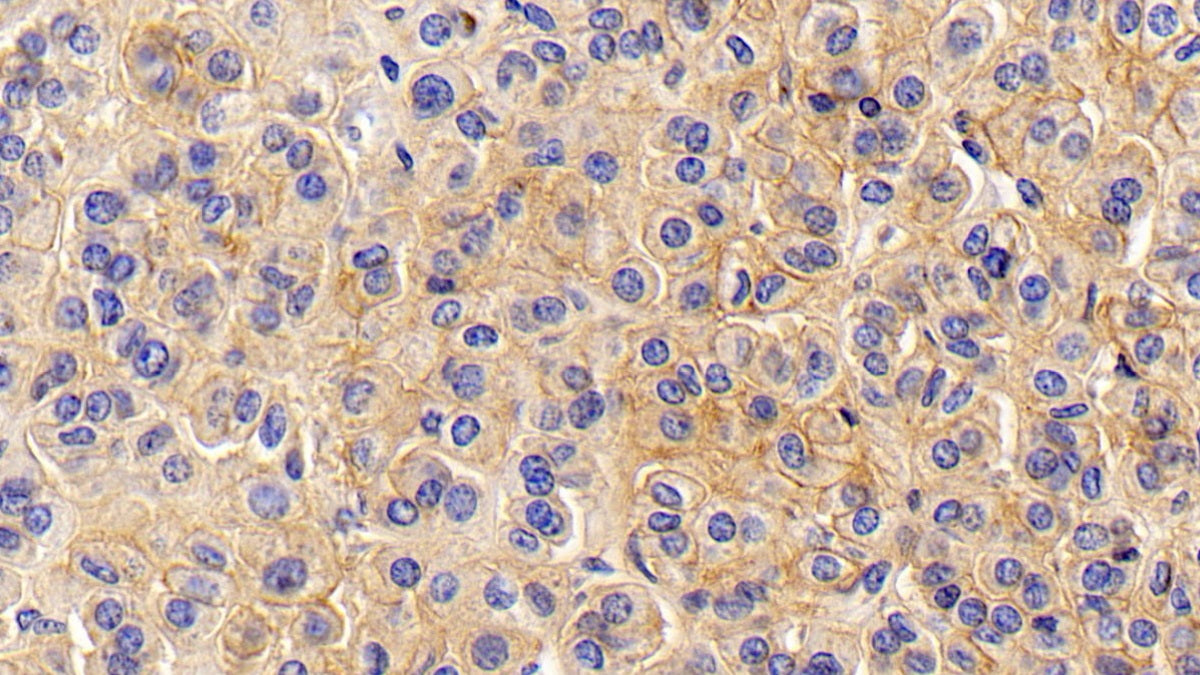 DAB staining on IHC-P; Sample: Human Rectum Tissue; Primary Ab: 30ug/ml Mouse Anti-Human CD147 Antibody; Second Ab: 2ug/mL HRP-Linked Caprine Anti-Mouse IgG Polyclonal Antibody