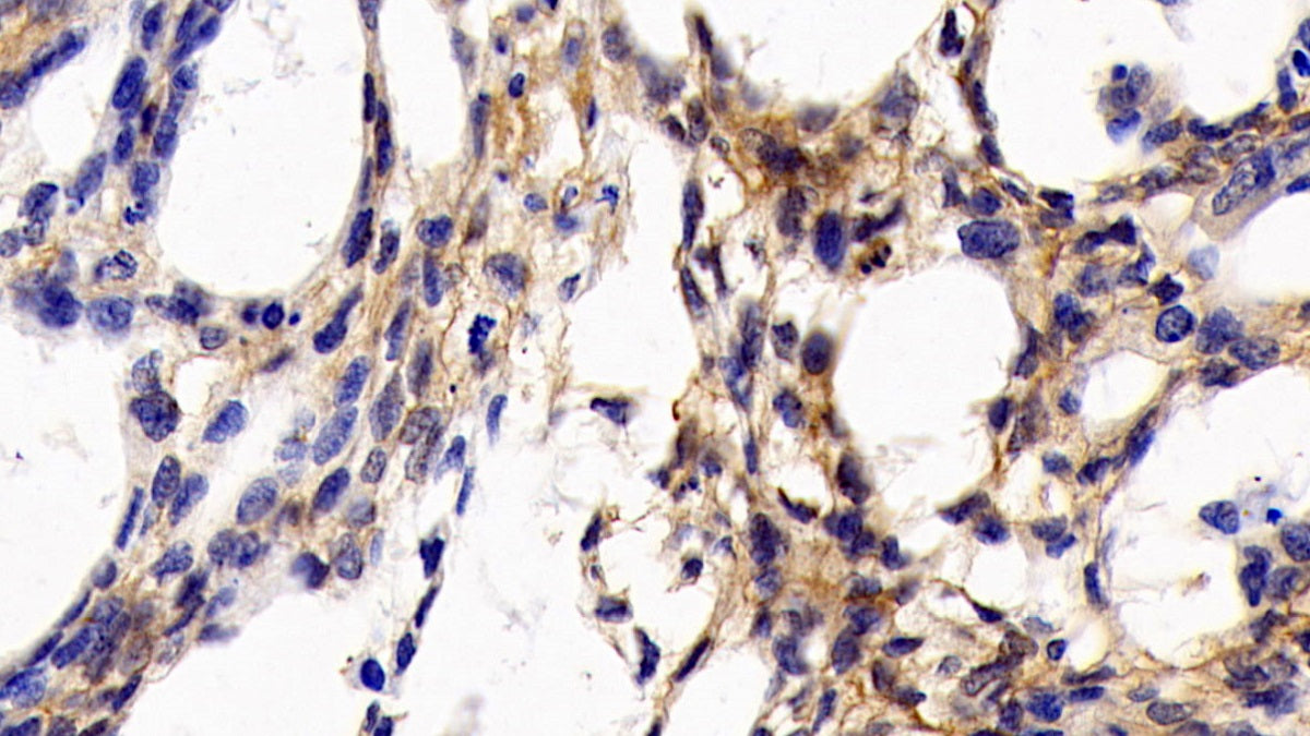 Cluster Of Differentiation 147 (CD147) Monoclonal Antibody - image 5