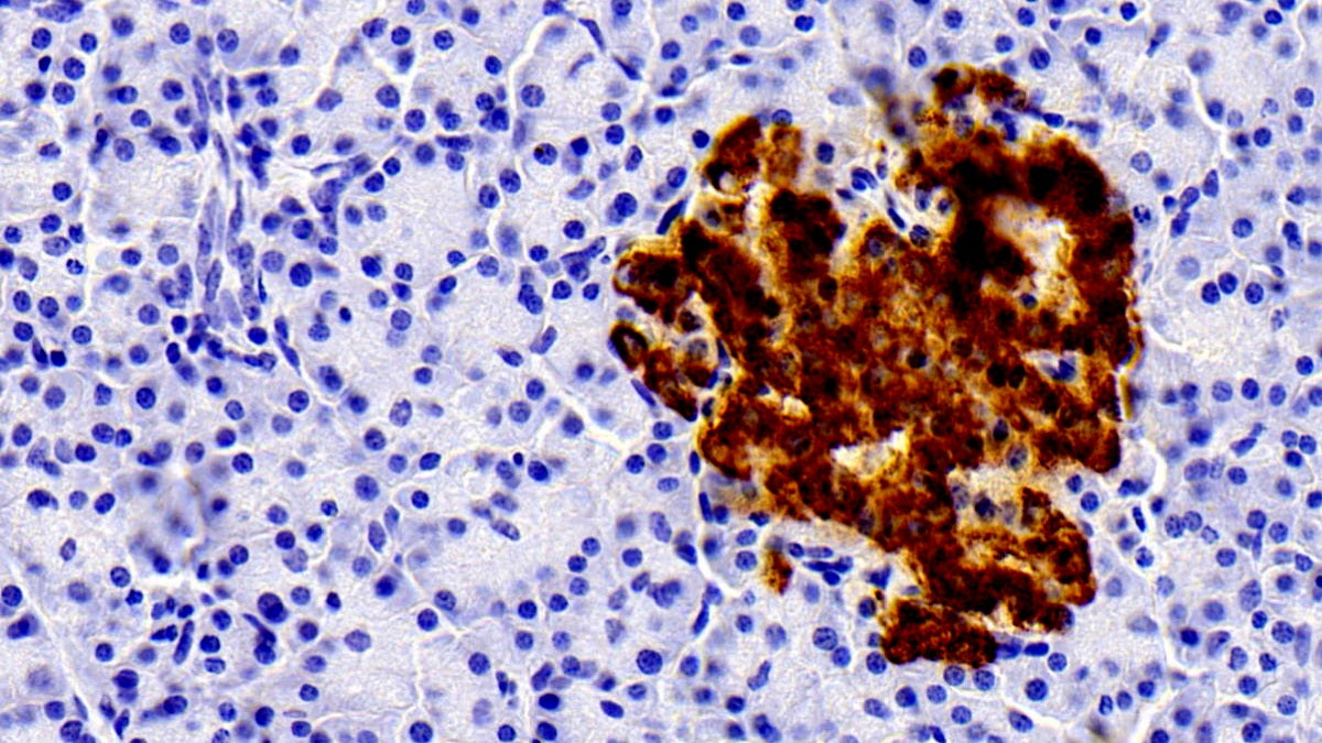 DAB staining on IHC-P; Sample: Human Pancreas Tissue; Primary Ab: 20ug/ml Mouse Anti-Human INS Antibody; Control: Used PBS instead of primary antibody; Second Ab: 2ug/ml HRP-Linked Caprine Anti-Mouse IgG Polyclonal Antibody