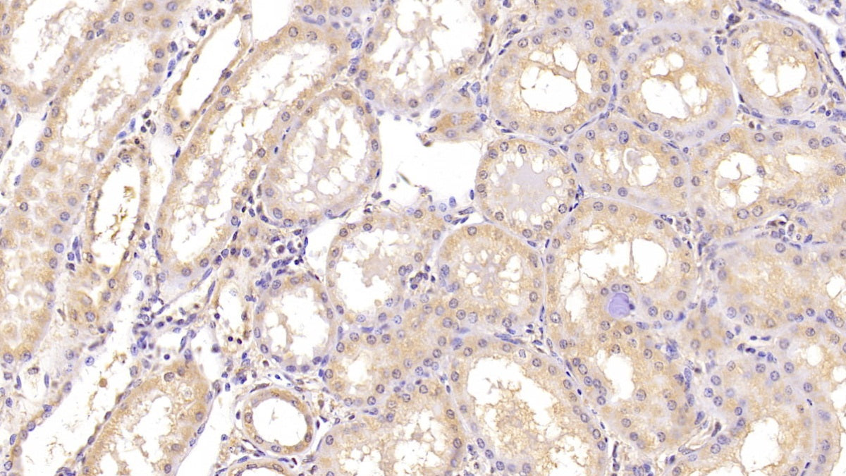DAB staining on IHC-P; Sample: Human Liver Tissue; Primary Ab: 40ug/ml Mouse Anti-Human ANG Antibody; Second Ab: 2ug/mL HRP-Linked Caprine Anti-Mouse IgG Polyclonal Antibody