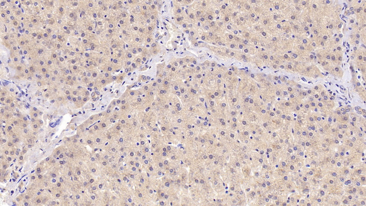 Angiogenin (ANG) Monoclonal Antibody - image 2
