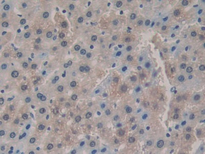 DAB staining on IHC-P; Sample: Rat Spinal cord Tissue; Primary Ab: 30ug/ml Mouse Anti-Rat IL1a Antibody; Second Ab: 2ug/mL HRP-Linked Caprine Anti-Mouse IgG Polyclonal Antibody