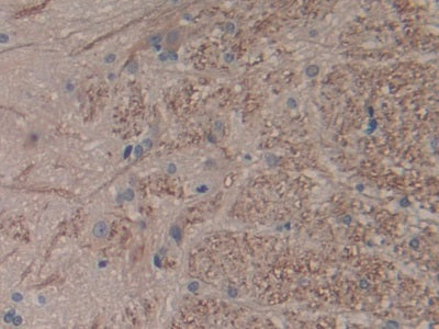 DAB staining on IHC-P; Sample: Rat Cerebrum Tissue; Primary Ab: 30ug/ml Mouse Anti-Rat IL1a Antibody; Second Ab: 2ug/mL HRP-Linked Caprine Anti-Mouse IgG Polyclonal Antibody