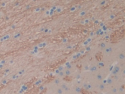 DAB staining on IHC-P; Sample: Rat Intestine Tissue; Primary Ab: 30ug/ml Mouse Anti-Rat IL1a Antibody; Second Ab: 2ug/mL HRP-Linked Caprine Anti-Mouse IgG Polyclonal Antibody