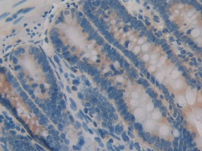 Interleukin 1 Alpha (IL1a) Monoclonal Antibody - image 5