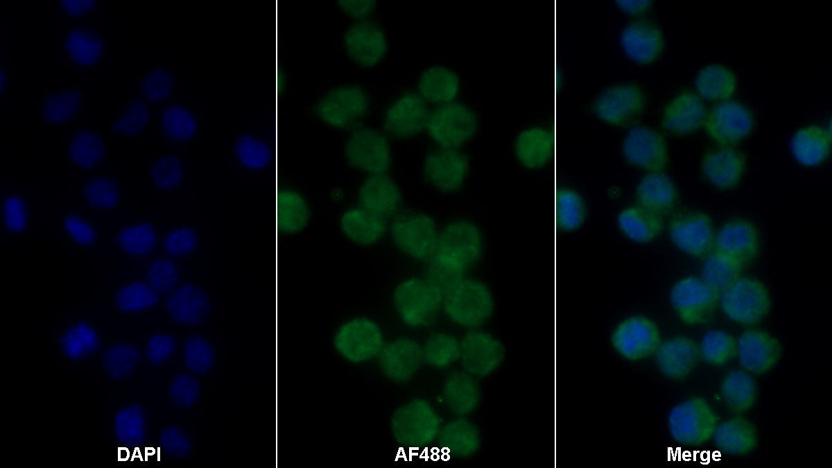 Interleukin 1 Beta (IL1b) Monoclonal Antibody - image 2