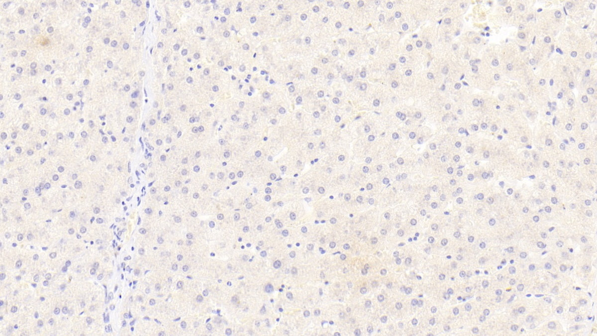 Sialic Acid Binding Ig Like Lectin 8 (SIGLEC8) Monoclonal Antibody - image 2