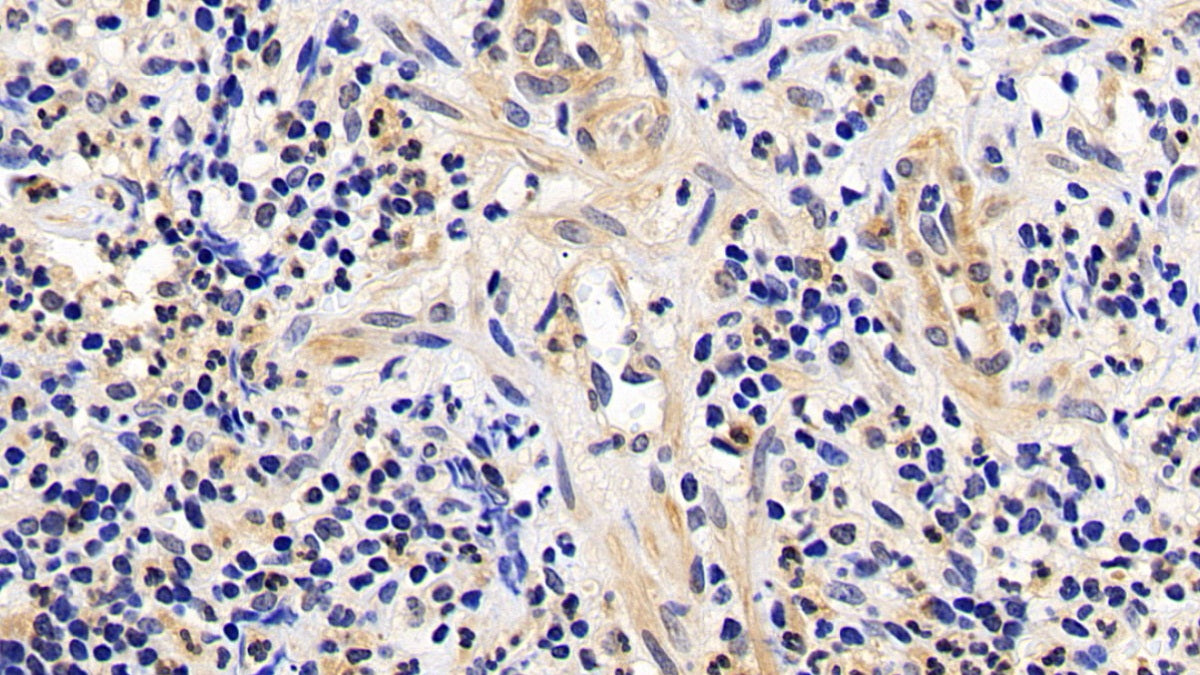 B-Cell Leukemia/Lymphoma 2 (Bcl2) Monoclonal Antibody - image 5