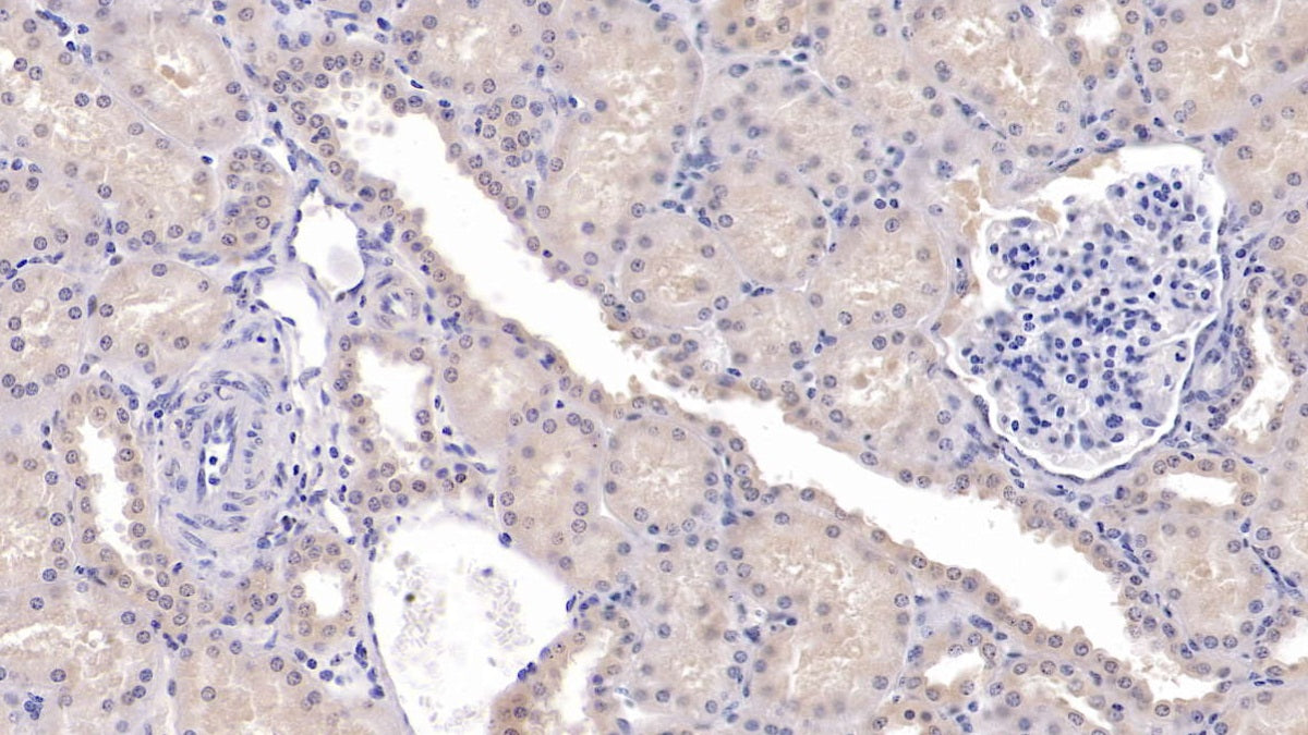 DAB staining on IHC-P; Sample: Human Cardiac Muscle Tissue; Primary Ab: 20ug/ml Mouse Anti-Human SFRP1 Antibody; Second Ab: 2ug/mL HRP-Linked Caprine Anti-Mouse IgG Polyclonal Antibody
