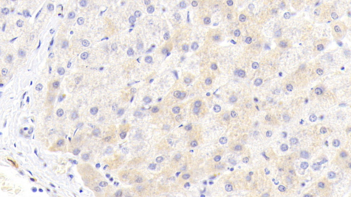 Western Blot; Sample: Lane1: Human Serum; Lane2: Human Plasma Primary Ab: 2ug/ml Mouse Anti-Human a1AT Antibody Second Ab: 0.2ug/mL HRP-Linked Caprine Anti-Mouse IgG Polyclonal Antibody