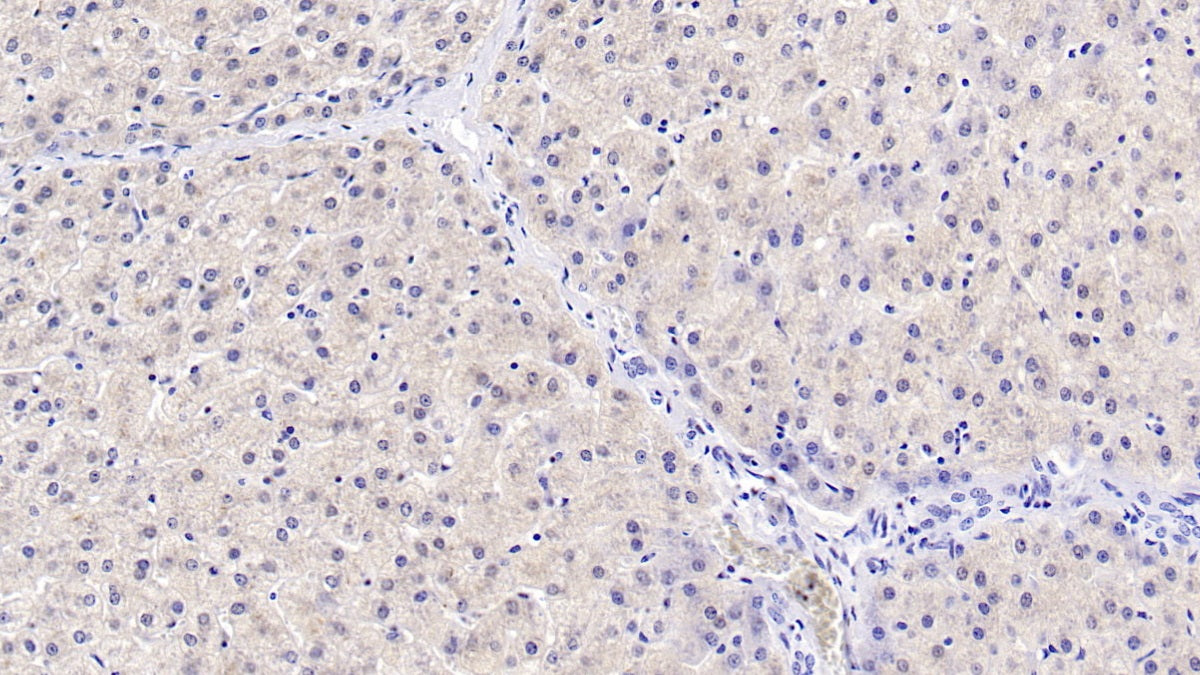 DAB staining on IHC-P; Sample: Human Liver Tissue; Primary Ab: 40ug/ml Mouse Anti-Human HPD Antibody; Control: Used PBS instead of primary antibody; Second Ab: 2ug/ml HRP-Linked Caprine Anti-Mouse IgG Polyclonal Antibody