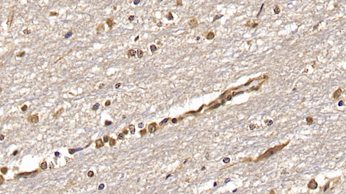 DAB staining on IHC-P; Samples: Human Colon Tissue; Primary Ab: 40ug/ml Mouse Anti-Human OAS2 Antibody; Second Ab: 2ug/mL HRP-Linked Caprine Anti-Mouse IgG Polyclonal Antibody