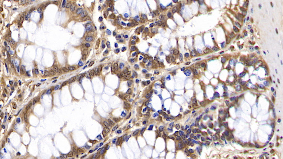 2',5'-Oligoadenylate Synthetase 2 (OAS2) Monoclonal Antibody - image 3